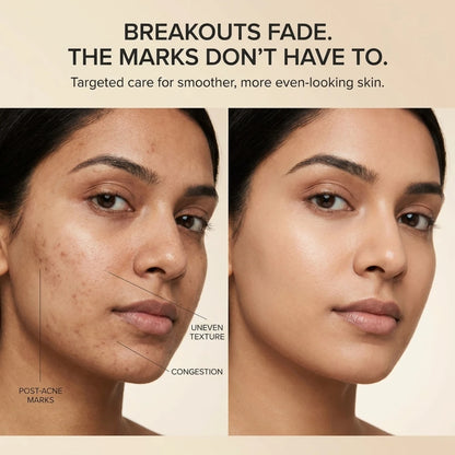 Nivara™ Succinic Acid Peeling Pad