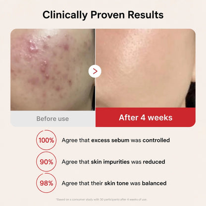 Nivara™ Succinic Acid Peeling Pad