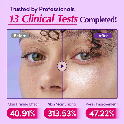 Follie™ - Bakuchiol Plumping Serum