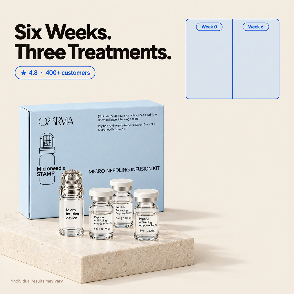 Oorvia Micro Infusion System kit — six weeks, three treatments
